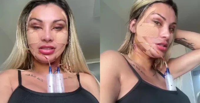Andressa-Urach-mostra-novo-rosto-apos-50-plastica-0036566301202605071331-9